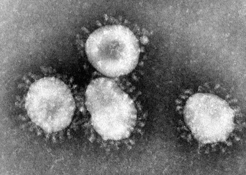 Virus Spread Exposes Fragility Of Global Markets