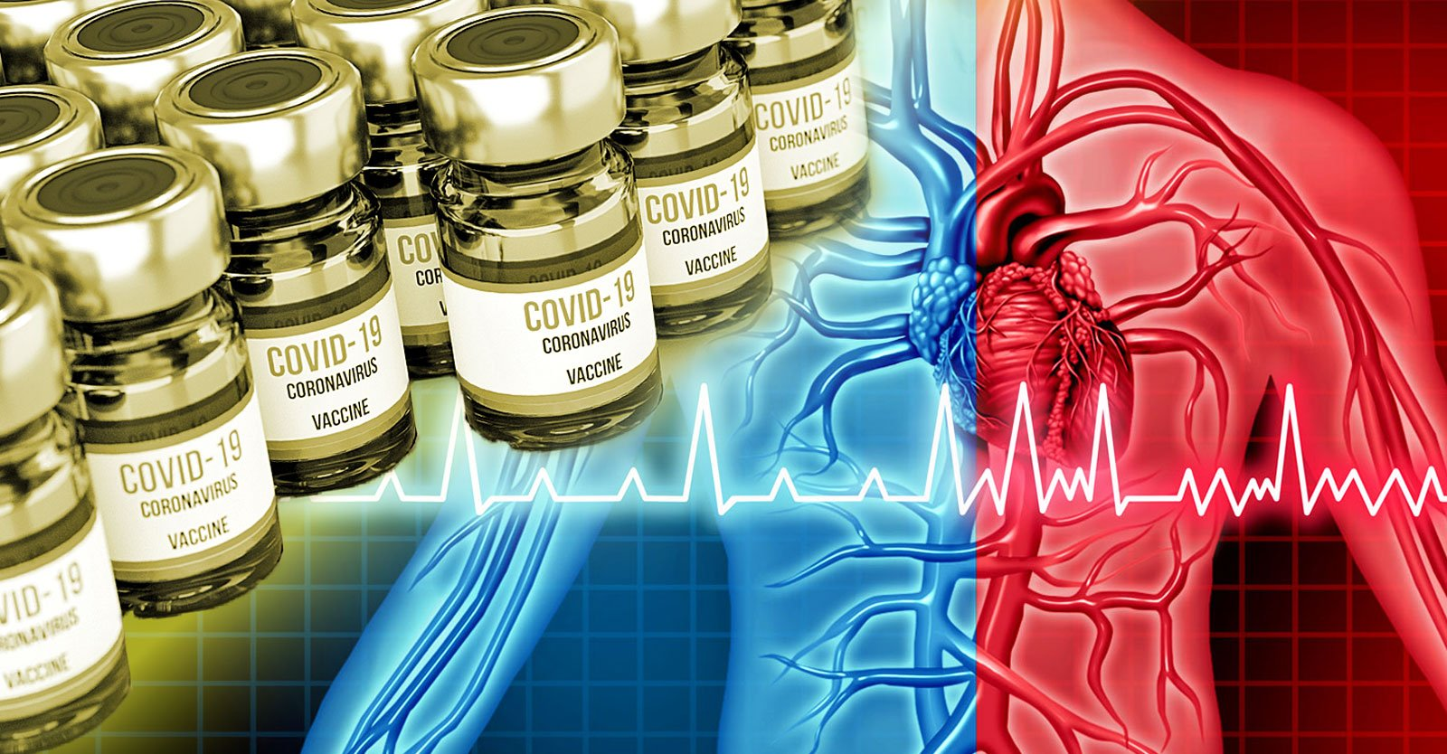 ‘Stunning’ 620% Higher Risk of Myocarditis After mRNA COVID Vaccines